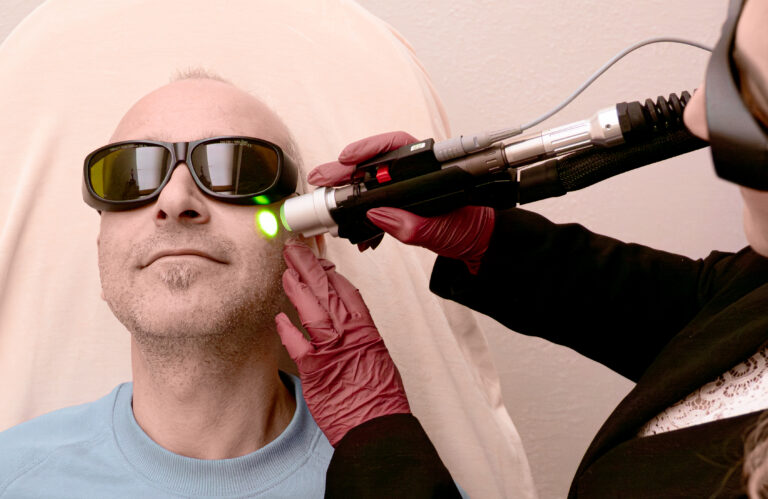 laser_behandlung_mann_bart